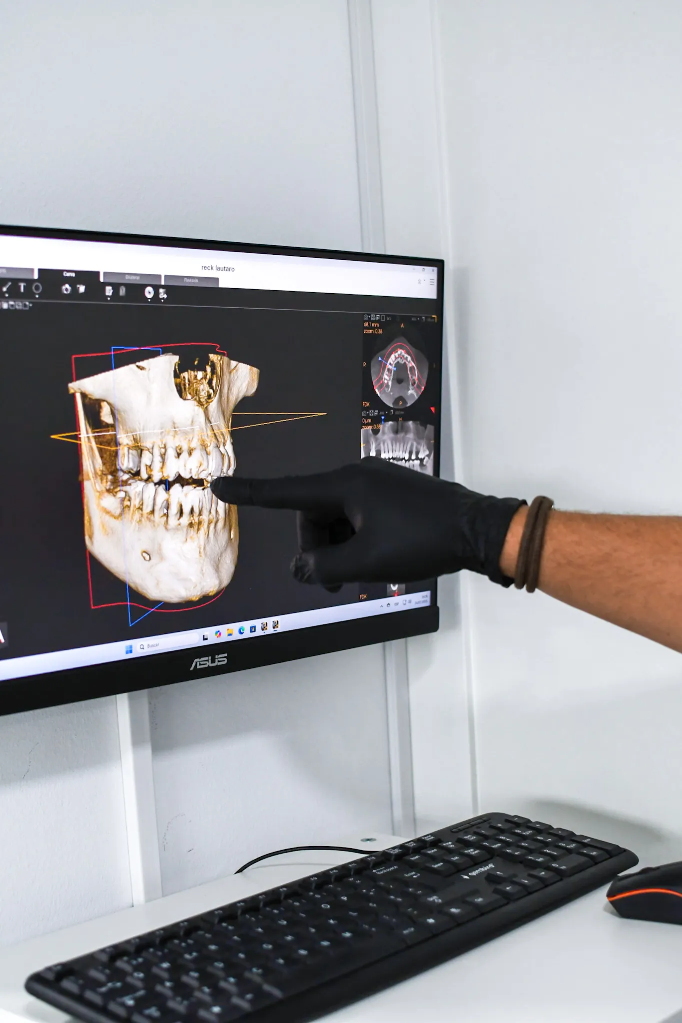 Doctor señalando representacion 3D computalizada.